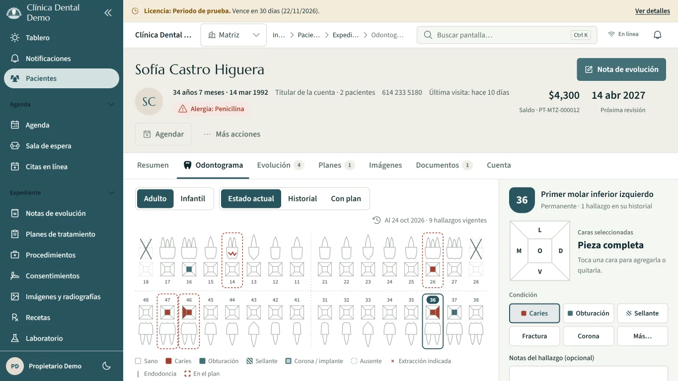 Expediente de Sofía Castro Higuera en la pestaña Odontograma: en la cabecera, 34 años, titular de la cuenta, alergia a la penicilina, saldo de $4,300 del plan PT-MTZ-000012 y próxima revisión el 14 de abril de 2027. Abajo, las 32 piezas con sus caras: caries en coral en la 26, 36, 46 y 47, la 14 fracturada, la 18 y la 28 ausentes, y la 36 seleccionada, primer molar inferior izquierdo, con su panel a la derecha.