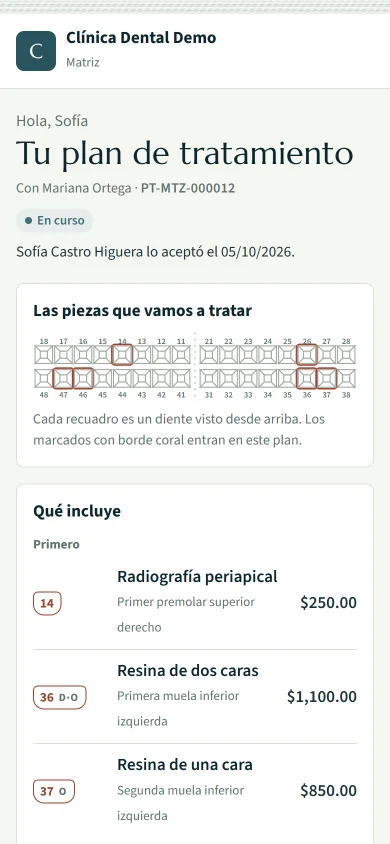 El presupuesto abierto en un teléfono: «Hola, Sofía. Tu plan de tratamiento», con Mariana Ortega, PT-MTZ-000012, en curso, aceptado por Sofía Castro Higuera el 5 de octubre de 2026. Debajo, las piezas que se van a tratar en un dibujo de la boca y lo que incluye en palabras sencillas: radiografía periapical del primer premolar superior derecho, $250; resina de dos caras en la primera muela inferior izquierda, $1,100; resina de una cara en la segunda muela inferior izquierda, $850.